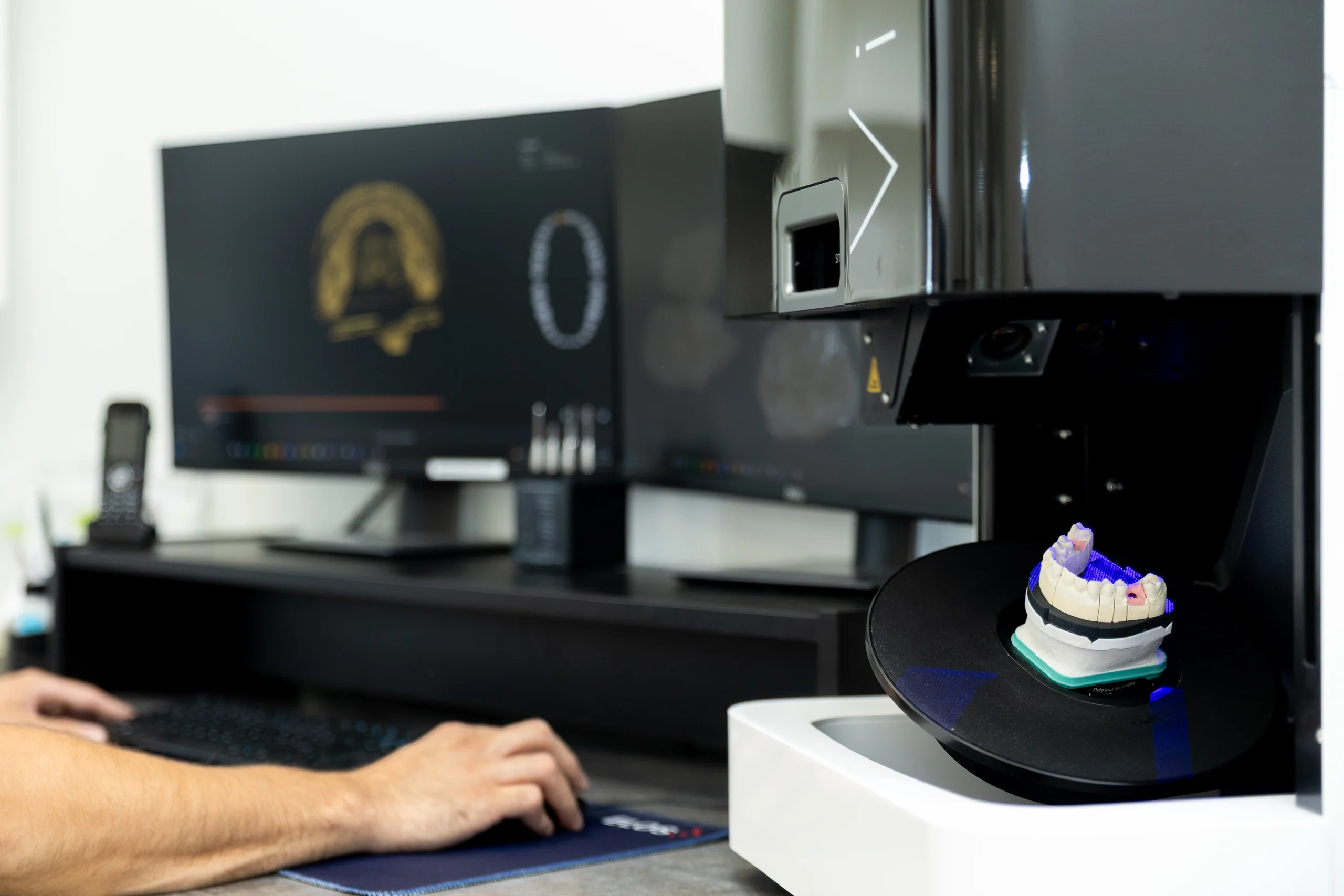 Optischer Modellscanner mit eingespanntem Modell, im Hintergrund die Konstruktionsansicht am Bildschirm